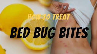 Bed Bug Bite Relief Effective Ways to Treat Bed Bug Bites  Remedies amp Tips [upl. by Mancino]