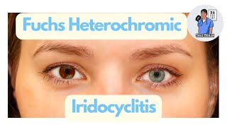 Fuchs Heterochromic Iridocyclitis FHC  What is this fascinating condition Eye Dr Explains 2023 [upl. by Wenoa553]