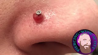 Piercing Bumps  Everything You Need To Know [upl. by Barbey]