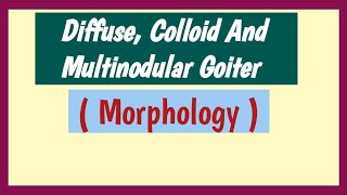 Diffuse Colloid And Multinodular Goiter  Pathology Morphology [upl. by Elay]