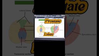 Prostate Ultrasound  Enlarged Prostate  BPH  Median Lobe Prostate  Prostatomegaly on Usg [upl. by Anyahs593]