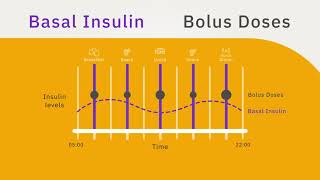 Basal amp Bolus Therapy [upl. by Alaj]