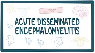 Acute disseminated encephalomyelitis ADEM [upl. by Dincolo]