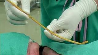 BougieAided Cricothyrotomy by Darren Braude [upl. by Naek]