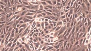 proliferating human kidney epithelial cell culture 1 [upl. by Aileahcim]