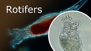 All About Rotifers Anatomy and Habitat Rotaria Macrura Under a Microscope 100x250x [upl. by Weatherby]