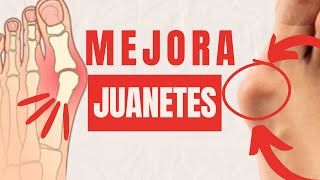 ¿JUANETES Mejóralos con estos ejercicios [upl. by Hairahcaz975]