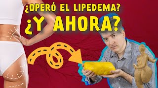 ¿Cómo es la vida después de la cirugía de lipedema [upl. by Llorrad231]