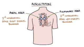 Heart Murmurs and Heart Sounds Visual Explanation for Students [upl. by Bogart]