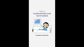 Supraventricular Tachycardia [upl. by Arianie]