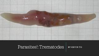 Trematode Life Cycle [upl. by Giorgio]