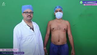 Revision Gynaecomastia Marking  Dr Jayanta Bain plastic amp cosmetic surgeon [upl. by Marjory372]