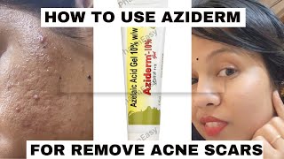 aziderm gel review honest reviewhow to use azelaic acid for acne amp acne marksacnetreatment viral [upl. by Ihcelek]