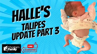 HALLE’S TALIPES JOURNEY PART 3 [upl. by Aronoh]