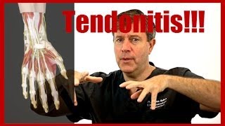 Do I Have Tendonitis In My Wrist [upl. by Zita]