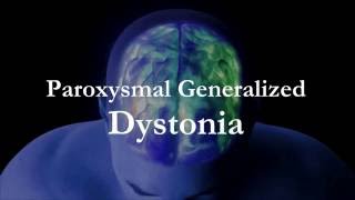 Dr Kukurin Paroxysmal Generalized Dystonia [upl. by Oznohpla]