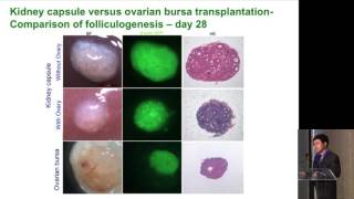 Germline Stem Cells and Therapeutic Potential  Lin Liu [upl. by Kavanaugh]