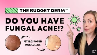 Do YOU have Fungal Acne  Dermatologist Talks Symptoms and Treatments [upl. by Jadwiga]