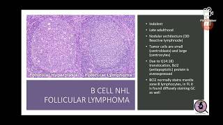 Lymphomas [upl. by Kathryn]