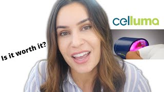 Celluma Pro Review and Update  Is Red Light Therapy WORTH IT [upl. by Niple200]