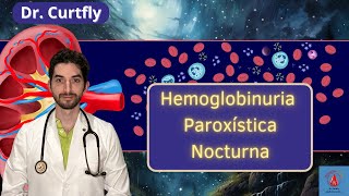 Hemoglobinuria Paroxística Nocturna Etiología Fisiopatología Clínica Diagnóstico y Tratamiento [upl. by Annahsor]