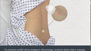 Lumbar Puncture Polish  Nakłucie lędźwiowe [upl. by Eitsirhc]