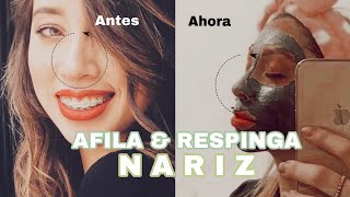 Afina y respinga tu nariz sin cirugía  Anderlyn Prado [upl. by Lehman340]