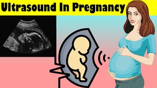 Ultrasound Scan In Pregnancy Obstetric Ultrasonography Pregnancy Ultrasound Scan [upl. by Tnecnev]