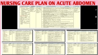 NCP 54 Nursing Care Plan on Acute Abdomen Abdominal Pain GI DisordersLEARN NURSiNG EASY [upl. by Mesics]