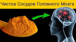 Как Очистить Сосуды Головного Мозга улучшить память концентрацию и внимание  Доктор Вивек [upl. by Tnomed]