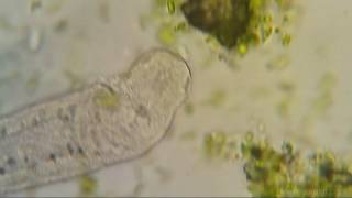 Unfiltered Water under Microscope HD [upl. by Eniala]