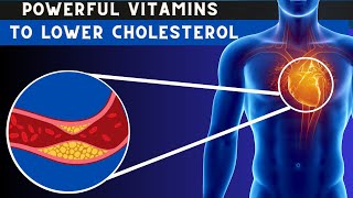 Lower Cholesterol  Top 7 Vitamins To Lower cholesterol Naturally [upl. by Ycaj]