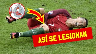 Lesión de los ligamentos de la rodilla ligamentos intra y extracapsulares [upl. by Atiuqer181]