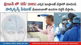 బ్రెయిన్ లో చిప్ DBS ఎక్కడ ఇంప్లాంట్ చేస్తారో చూడండి  మేలుకావాలో ఉండగా సర్జరీ చేస్తారు [upl. by Primaveras]