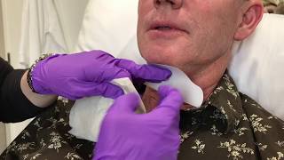 Kybella Injections by an Allergan Nurse Educator  Skin365 [upl. by Pearla]