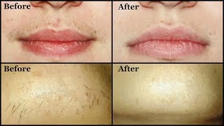 Remove UNWANTED UPPER LIP HAIR amp CHIN HAIR by yourself easily at home  Mamtha Nair [upl. by Alekim418]