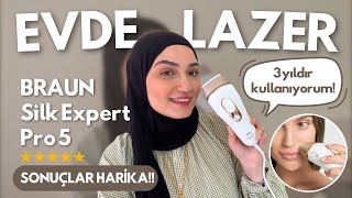 Braun Silk Expert Pro 5 İnceleme  3 Senelik Kullanım Sonuçlarım  Sonuçlar Harika evdelazer [upl. by Ila27]