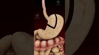 Gastric Bypass Laparoscopic Treatment shorts  creativelearning3d [upl. by Akcirahs]