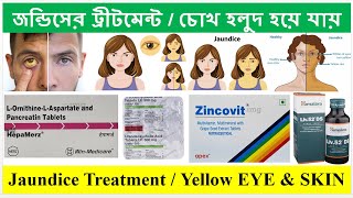 Jaundice Treatment in Bangla  Bong Pharma [upl. by Phelips302]