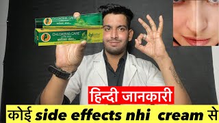 कोई side effects nhi cream से  Chloasma care cream  Chloasma care cream review  Chloasma care [upl. by Zehc]