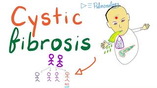 Cystic Fibrosis  Definition Pathogenesis Symptoms and Complications  Genetics [upl. by Azer]