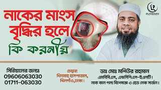 নাকের মাংস বৃদ্ধি হলে কি করনীয়  DrMashiur Rahman  ডাঃ মোঃ মশিউর রহমান [upl. by Anhcar]