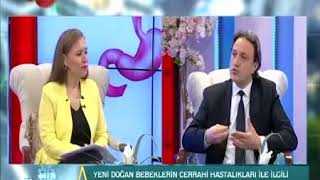 Özofagus Atrezisi nedir [upl. by Debbee]