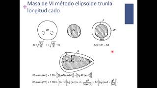 Ecocardiografia Funcion cardiaca [upl. by Paschasia]