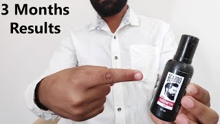 Beardo Beard Growth oil Review In Hindi After 3 Months How To Use Results [upl. by Janyte198]