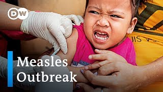 Global measles infections on the rise  DW News [upl. by Aianat]