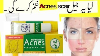 Mentholatum scar Care cream review with price [upl. by Corbet]