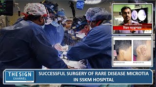 Successful surgery of rare disease microtia in SSKM hospital [upl. by Cohby]