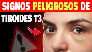 Descubre los 8 Peores Síntomas del Hipotiroidismo y Cómo Afectan tus Hormonas Tiroideas [upl. by Madigan]