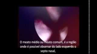 Endoscopia em Equino Vídeoaula [upl. by Aundrea]